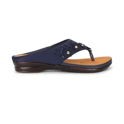 ORTHO JOY Women Embellished Open Toe Flats-picture-19