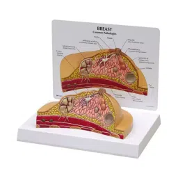 A-ONE SCIENCE Multicolor PVC Diseased Breast Model AOSBM167-picture-16