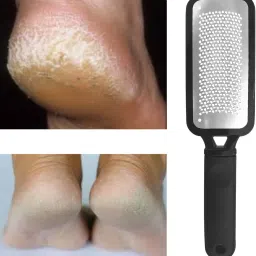 Foot Scrubber Tool For Heel Crack Remover , Dead Skin & Heel Repair-image-86