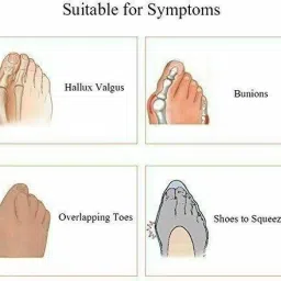 erinshop Toe Separators Ring for Overlapping Big Toes, Bunions, Alignment, Spacers image 3