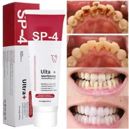 SP 4 Ultra Brightening Toothpaste for Stain Removal Toothpaste 30g Teeth Whitening Kit-picture-6