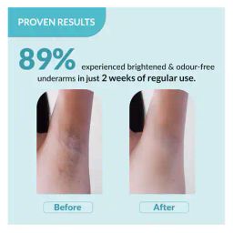 fixderma Nigrifix Exfoliates Underarm Ocean Roll On image 4