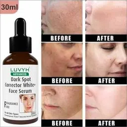 luvyh Women Skin Brightening + Dark Spot Serum -picture-2