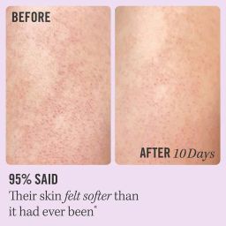 first aid beauty KP Bump Eraser Body Scrub with 10 AHA image 2