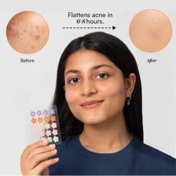 gush Dart It Hydrocolloid Pimple Patches for Healing Acne Zits and Blemishes - Flower image 2