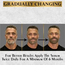 MANCODE Anti Grey Hair & Beard Serum - 30ml image 3