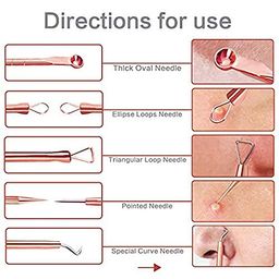 MACPLUS 4Pcs Blackhead Pimple Golden Remover Tools for Professional Tweezers Kit for Remove Acne Comedone Extractor, Black Heads Removing on Face Removal image 3