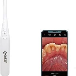 QAWACHH 6 LED Professional Dental Intraoral 720P HD,Digital Micro Waterproof Teeth Camera (white)-image-63