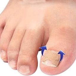 Ingrown Toe Nail Repair Foot Corrector Stickers Paronychia Treatment 50pcs | Toe Nail Correction Tape | for Effective Paronychia Treatment and Nail Repair | Slim and Discreet Stickers-image-44