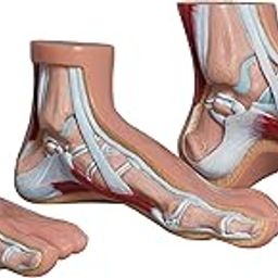 Labzio- Normal foot, Arched Foot, Flat Foot coloured models, Natural size, Set of 3,with detailed coloured key cards-3-1
