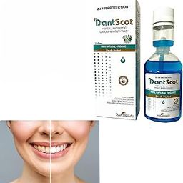 Mint Mouthwash | Mouth Freshener For Dental Hygiene & Fresh Breath | No Artificial Flavors & Colors | Alcohol Free Mouth Wash for Men Women & Kids | Fights Germs-image-53