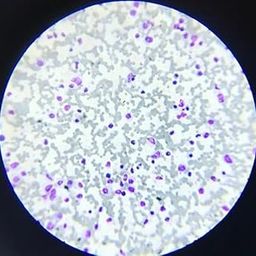 BIOLLOGICAL HUB - HUMAN BLOOD CELLS RBC & WBC SLIDES-17