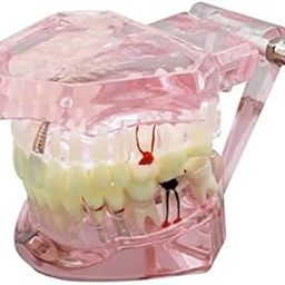 Dental Tool All in one model (Pink Colour)(Pack Of 1)-image-86