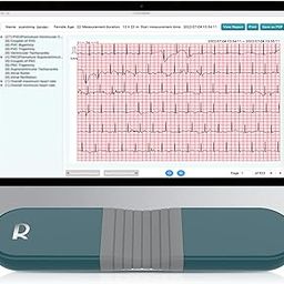 AI HR Monitor, 24 Hours Chest Lead Device with Free AI Analysis & PC Report, Chargeable Recorder, HHM1-picture-26