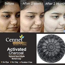Cennet Handmade Chemical Free Charcoal Soap For Women Skin Whitening, Natural Detox Face & Body Soap for Acne, Blackheads, Anti Wrinkle, Pimple Skin Care Charcoal Soap.|100 g.-image-38