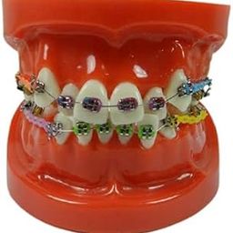 NMD Dental Ortho Model With Implants-image-26
