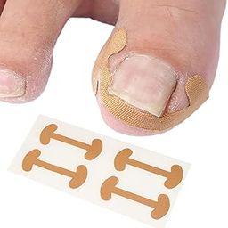 MVM Enterprise Ingrown Toenails Tool Set 5 Pieces Toenails Correction Patch, Toenail Elastic Patch Correction Plaster with Nail File, Pedicure Toenails Sticker Correction Plaster-21