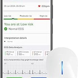 Sunfox Spandan ECG 4.0 with Pack of 20 electrodes | Portable ECG Monitor | Home/Clinic Use | Portable ECG Machine | Medical Grade ECG Device | Heart Rate Monitor | 12 Lead ECG | SharkTank Product |-2