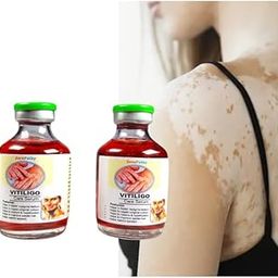 Vitiligo cream | Super Effective on White Patches, Discoloration of Scar Gel for Skin Spot natural to Improve Pigmentation & Promote Healthy Skin Rejuvenation-image-14