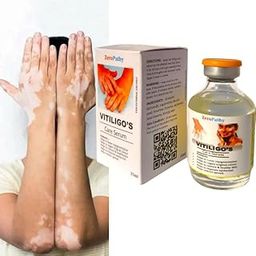 ZeroPathy Skin Brightening Cream for Vitiligo 35ml | Safed Dag Organic Skin | Sada Dag Herbal Spot Repair | Venmai Pulligal White Patch Lightening-image-2