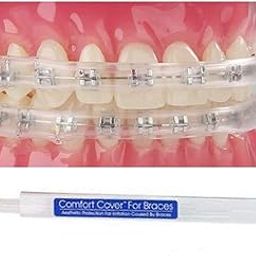 Sonic Technology Dental Orthodontic Mouth Guard-image-23