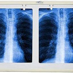 MEDIGUARD Premium Xray View Box, Double Film LED X-Ray View Box with Automatic Film Activation Censor and Variable Brightness Controller Pack of 1, 28X17 Inch-image-11