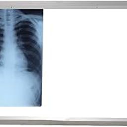 IS IndoSurgicals Ultra Slim, Double Film X-Ray View Box With Sensor & Dimmer for Brightness Adjustment-picture-21