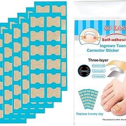 BNF®1 Set Ingrown Toenail Corrector Stickers Toe Nail Treatment Patch 120 Sheets| Nail Care, Manicure & Pedicure | Manicure/Pedicure Tools & Kits|1 Set Ingrown Toenail Corrector Stickers-31