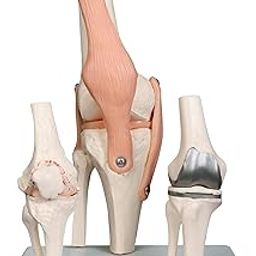 Kay Kay Industries Premium Knee Joint Model Anatomy Set | Life Size Knee Joint + 2nd Stage Osteoarthritic Knee + Knee with Implant Demonstration | Anatomical Skeleton, Made with Unbreakable PVC-28
