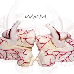wkm Silicone Human Brain Model Structure Life Size Anatomy Removable in 8 Parts image 4