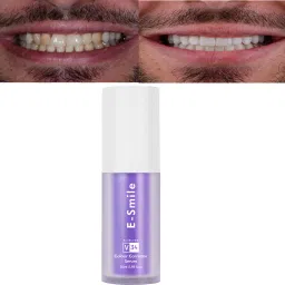 E-Smile V34 Corrector Serum Fast-Acting Teeth Whitening with Color-Correcting Teeth Whitening Kit-20