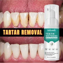 Teeth Whitening Foam To Deeply Cleaning Gums, Stain Removal Teeth Liquid Teeth Whitening Liquid-15