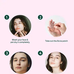 MOUNTAINOR Acne Pimple Patch with Hydrocolloid & Tea Tree - 36 Patches image 2