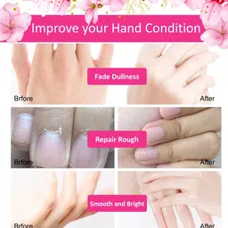 MasKing Set Of 4 Moisturizing & Hydrating Hand Masks 20gm Each image 4