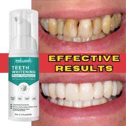 Teeth Whitening Foam To Remove Yellow Stains | Teeth Whitening Liquid Toothpaste-image-53
