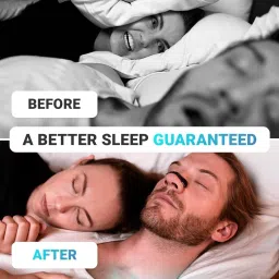 ramya beauty care Nasal Breathing Strip Starter Kit Boost Oxygen Intake, Reduce Snoring Anti-snoring Device image 2