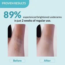 FIXDERMA Set of 3 Nigrifix Underarm Lightening Roll On - 60 ml each image 5