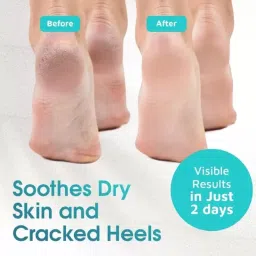 PEDI ROLLER WITH FOOT SERUM-image-99
