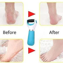 thtc Callus Remover for Feet,USB Rechargeable Electronic Foot File-picture-18