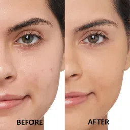 wonholli Orange Corrector Concealer Matte Finish Concealer image 3