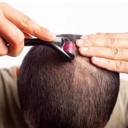 Derma Roller 0.5mm Titanium for Hair, Beard, Face, Acne & Skin Care-image-37