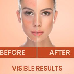 BHOOMI HERBAL INDIA Vitamin C Sheet Mask - 20 ml image 4
