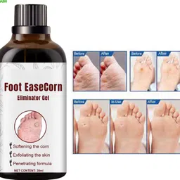 ayyiashi Safe Corn Remover Gel 30ml Daily Therapy Pack Smooth Feet Solution-picture-3