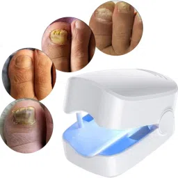 Rechargeable LASER Nail Fungus Treatment Device|Effective Onychomycosis Repair-image-27
