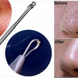 Stainless Steel Blackhead Remover Needle-image-79