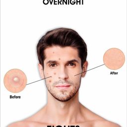 URBANGABRU Men Invisible Acne Pimple Patch Stickers with 100% Hydrocolloid - 72 Patches image 2