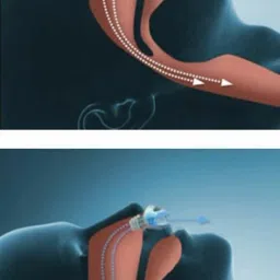 house of common 2 IN 1 Snore Nose Clip Anti-snoring Device image 4