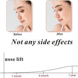 riddhu mart Nose Clipper Correction Shaper For Nose Shaping Tool Nose Shaper Nose Shaper image 4