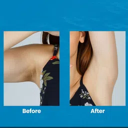 TLC 365 Deep Ocean Underarm Roll On- 40 ml image 4