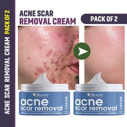 KURAIY Set Of 2 Acne Removal Cream-19